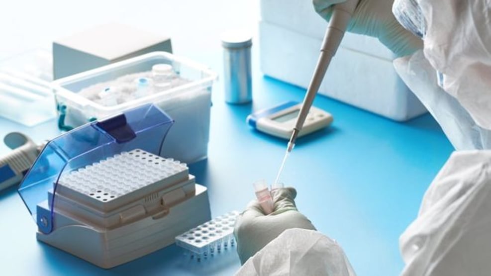 Laboratórios de SP relatam falta de testes de Covid