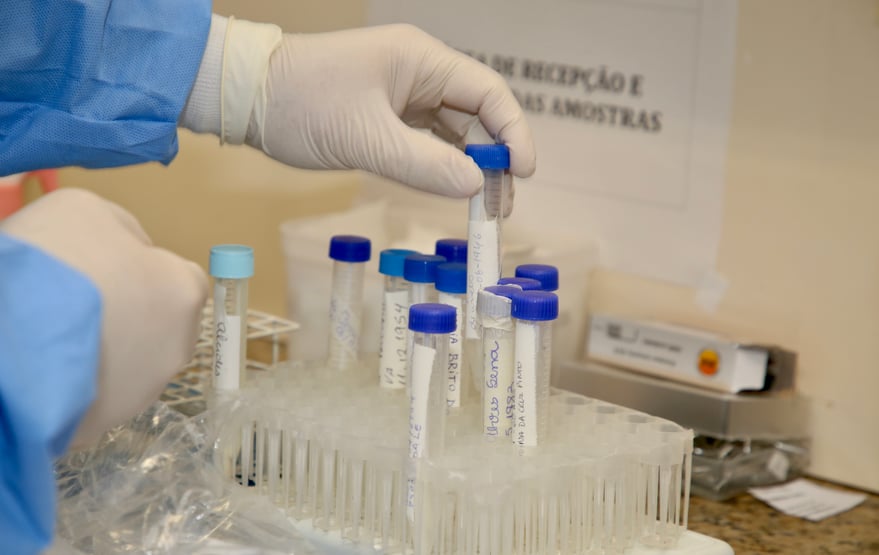 Brasil retoma testes da vacina de Oxford