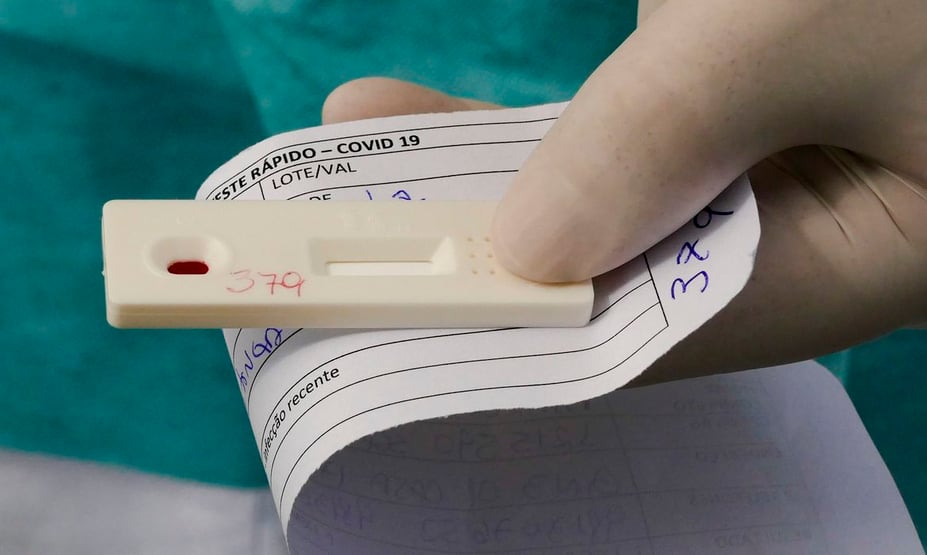 Brasil registra primeiro caso da Ômicron XE