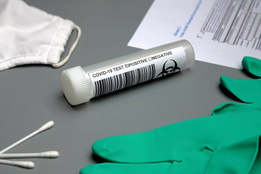 Pesquisadores de Hong Kong afirmam que 3ª dose de Coronavac não protege contra Ômicron