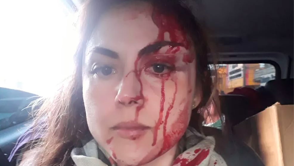 Procurador agride brutalmente uma colega em prefeitura no interior de São Paulo