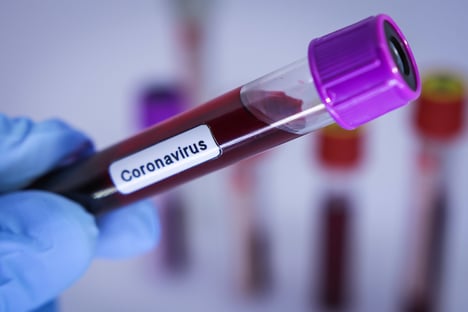 Saúde informa que já realizou quase 154 mil testes para Covid-19