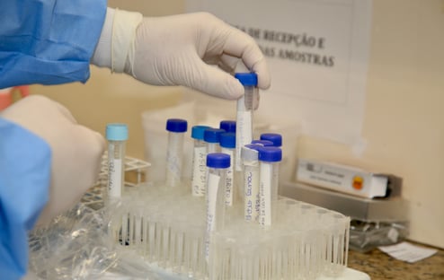Brasil retoma testes da vacina de Oxford