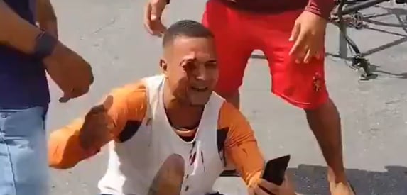 PM que cegou homem em protesto em Recife é afastado