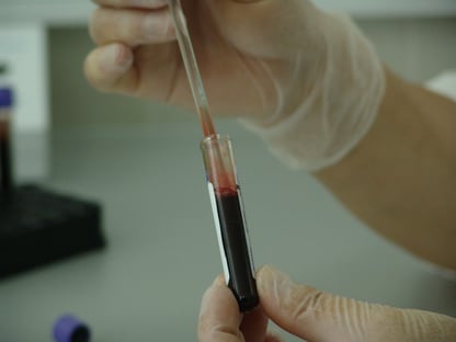 OMS não recomenda uso de plasma convalescente em tratamento contra Covid