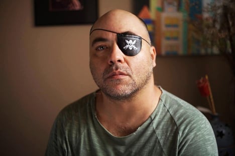 10 x 1 – Supremo manda SP indenizar fotógrafo baleado no olho pela PM