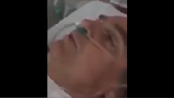 bolsonaro-posta-video-de-cirurgia-apos-facada-nem-sabia-que-existia
