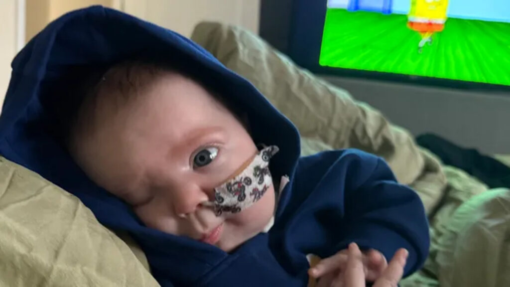O caso de Vinnie James: Bebê nasce com orelha na bochecha