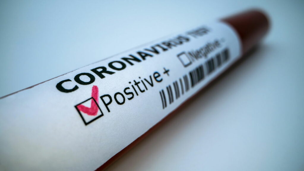 Novo Coronavírus 2.0 é descoberto na China com potencia de nova pandemia