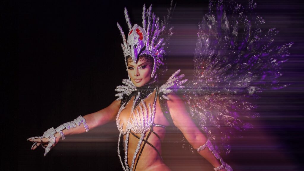 Viviane Araújo e a polêmica da hérnia umbilical