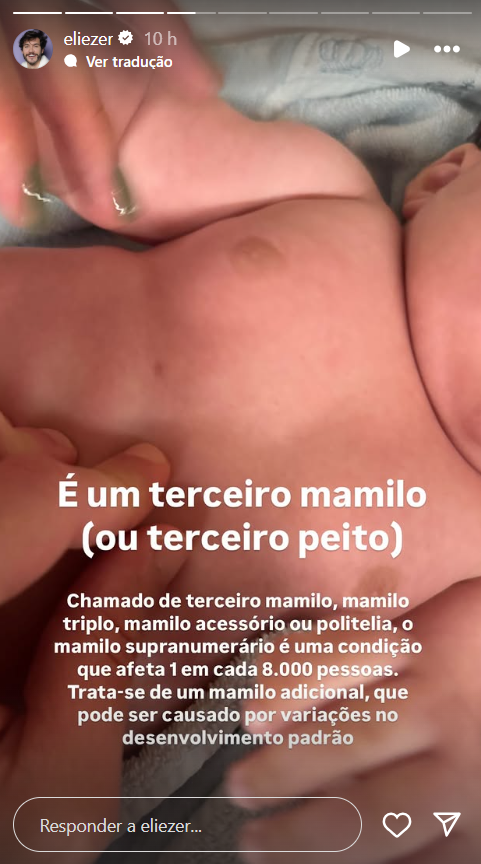 O influenciador Eliezer compartilhou recentemente nas redes sociais uma condição rara que afeta seu filho caçula, Ravi.