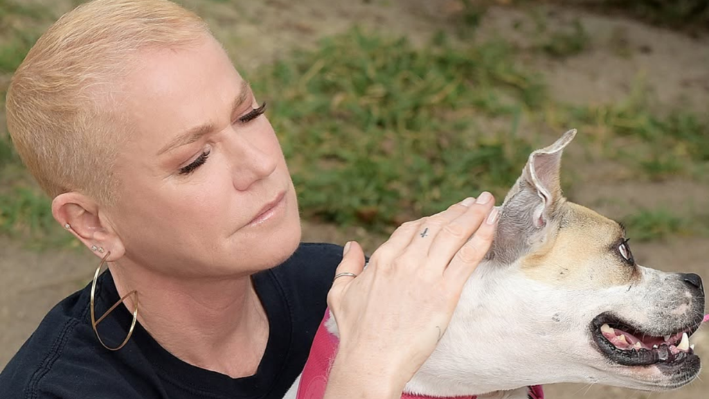 Xuxa Meneghel revela ter feito implante capilar