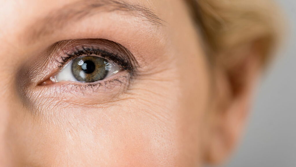 Olhos dizem tudo! Veja como cuidar dessa área, prevenindo olheiras e sinais de envelhecimento