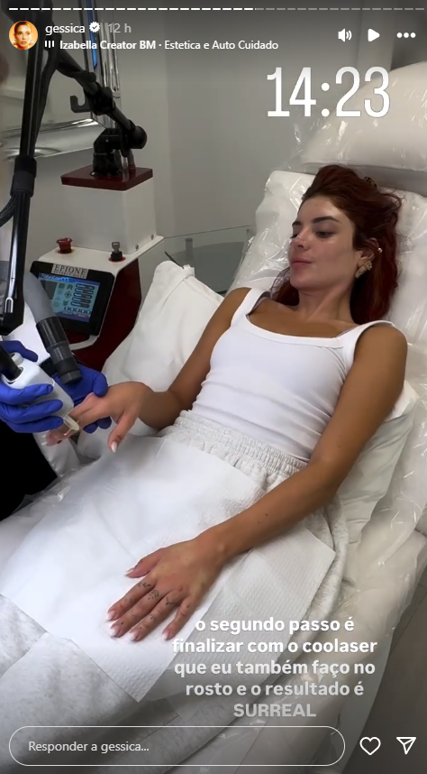 Gkay surpreende ao revelar nova harmonização