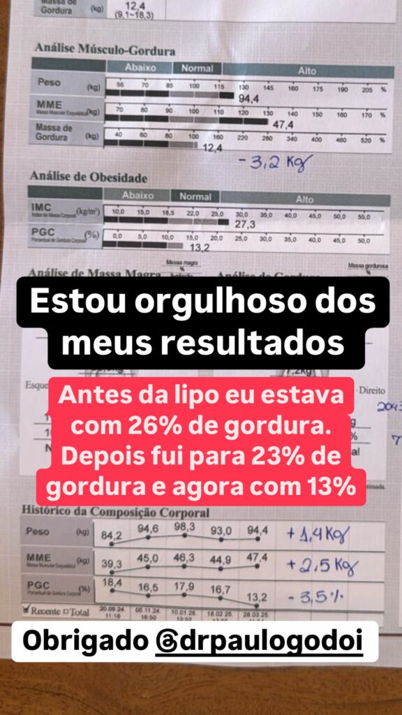 Eliezer surpreende com antes e depois do próprio corpo
