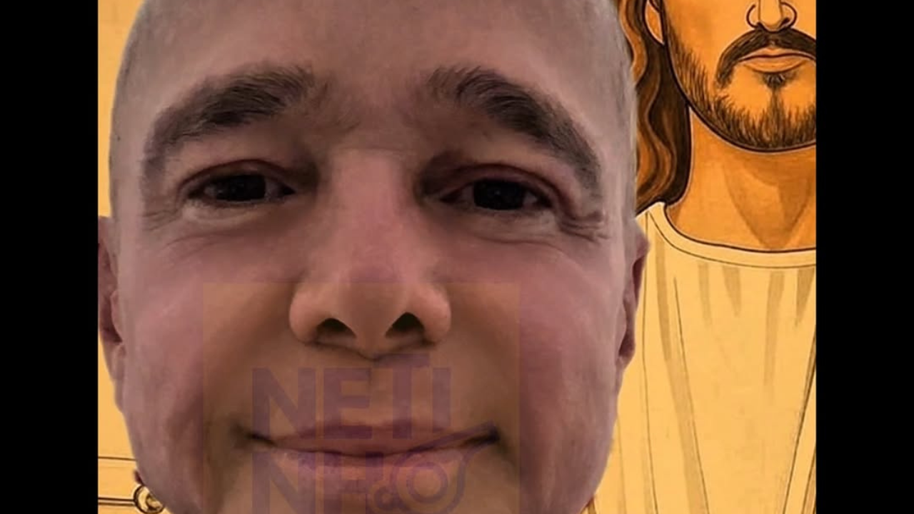 Netinho revela que vai precisar de transplante de medula