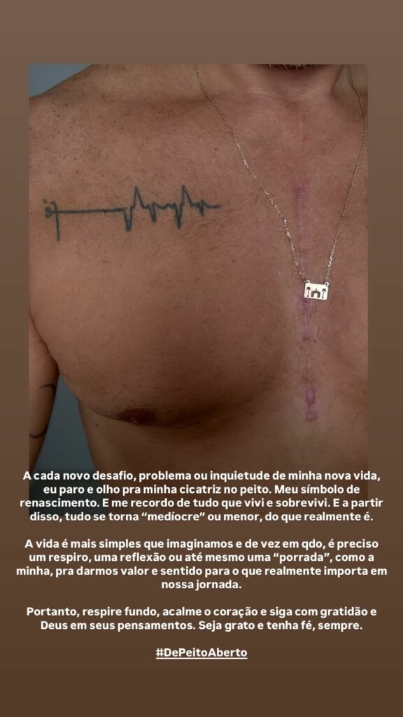 Otaviano Costa mostra cicatriz de cirurgia realizada