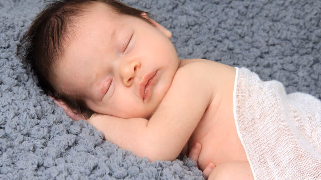 ‘Síndrome do Lobisomem’ pode surgir em bebês após contato com minoxidil, alerta Anvisa