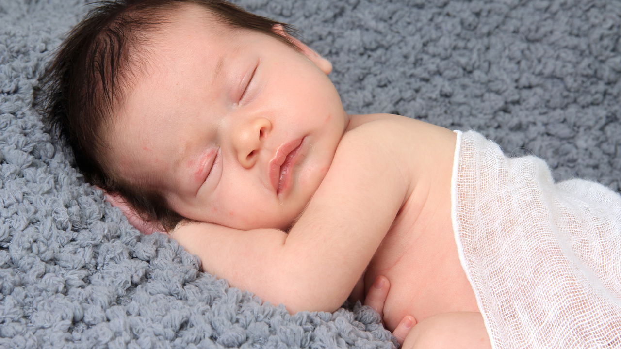 ‘Síndrome do Lobisomem’ pode surgir em bebês após contato com minoxidil, alerta Anvisa