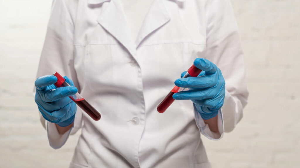 Quem tem esse tipo sanguíneo pode viver mais tempo que outros