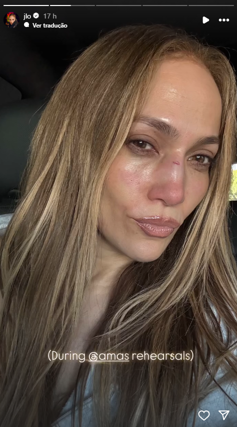 Jennifer Lopez revela acidente em ensaios para o AMAs