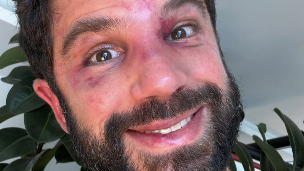 Popó confirma favoritismo e vence Duda Nagle no Fight Music Show