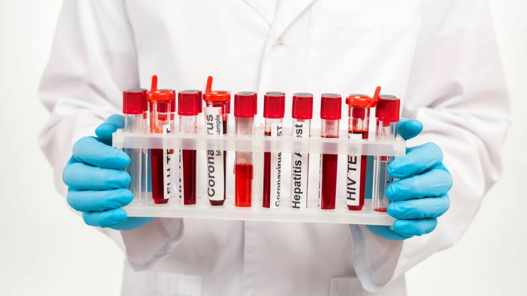 Com um simples exame de sangue você pode saber seu "tempo de vida"