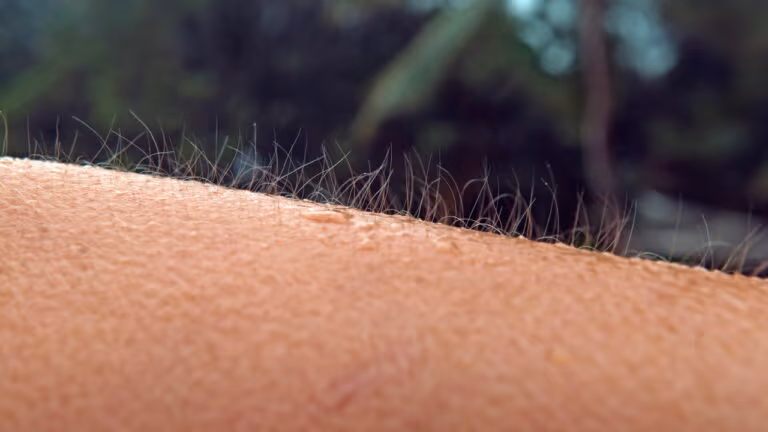 Imagem Item