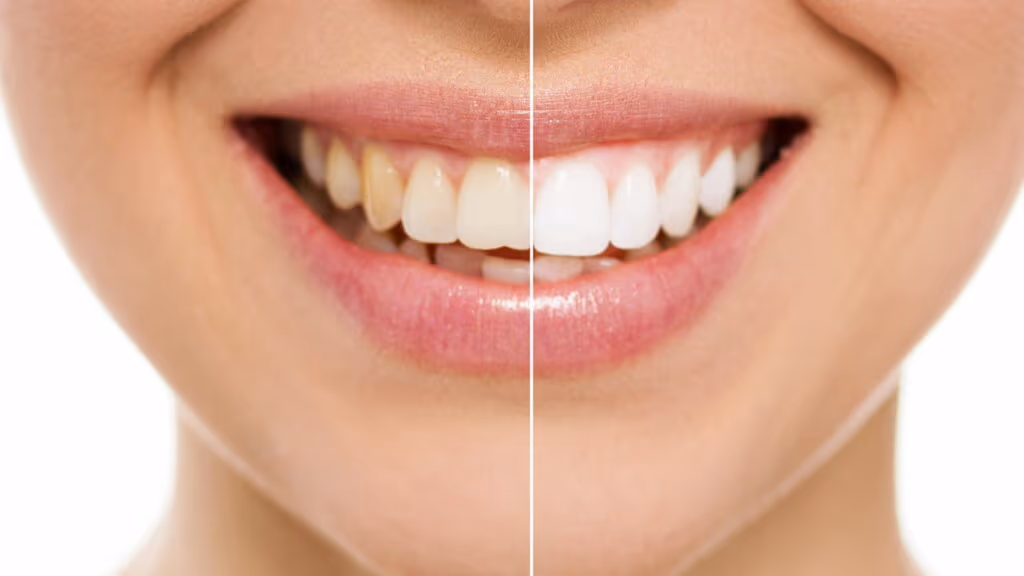 Essa técnica simples pode transformar seus dentes em poucos dias
