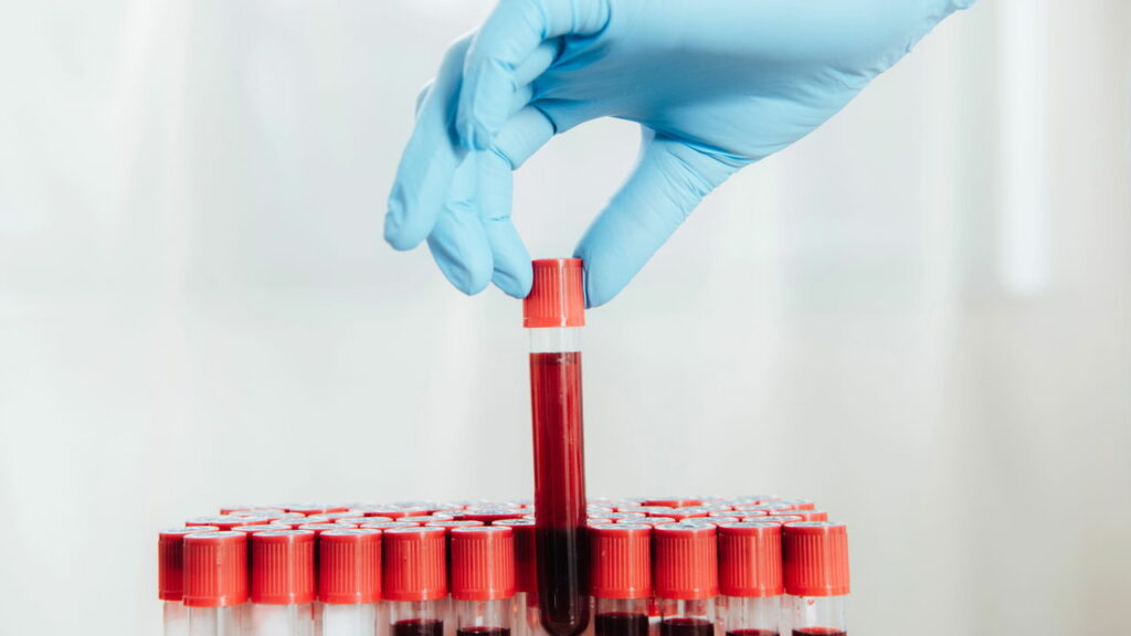 Sangue dourado O que é esse tipo sanguíneo raro e quais suas desvantagens