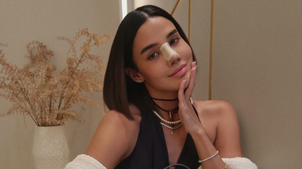 Ex-BBB Kerline mostra resultado da rinoplastia