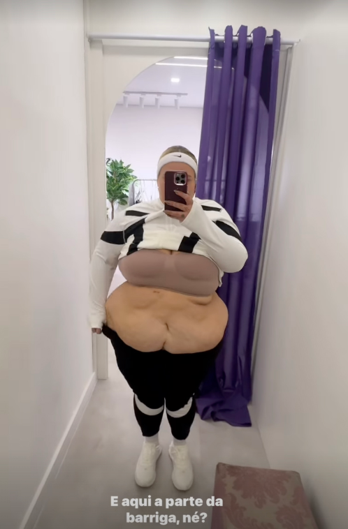 Thais Carla mostra barriga após cirurgia bariátrica