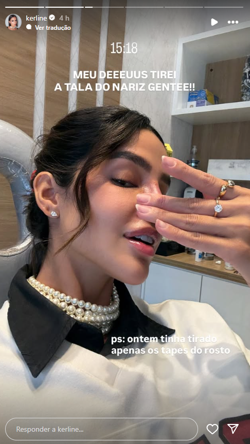 Ex-BBB Kerline mostra resultado da rinoplastia