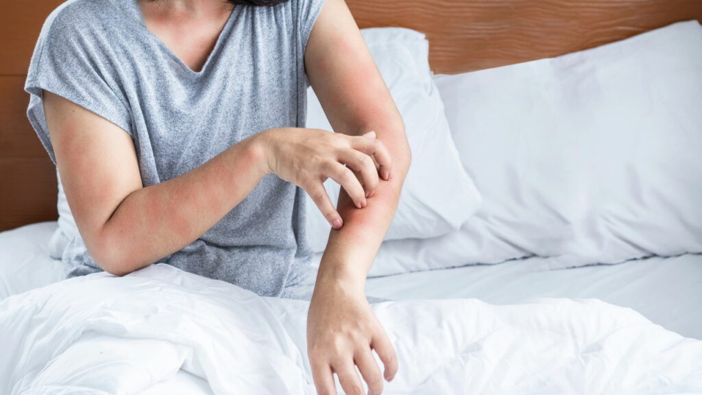 Esse inseto sobe na sua cama à noite e você nem percebe