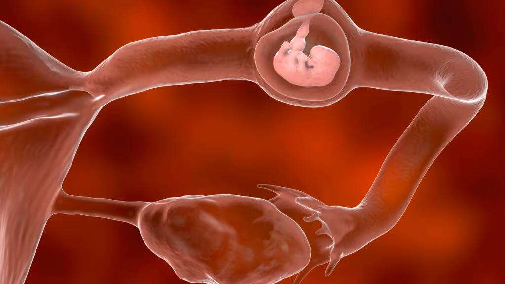 Cirurgia de laqueadura acaba com pernas amputadas e transplante