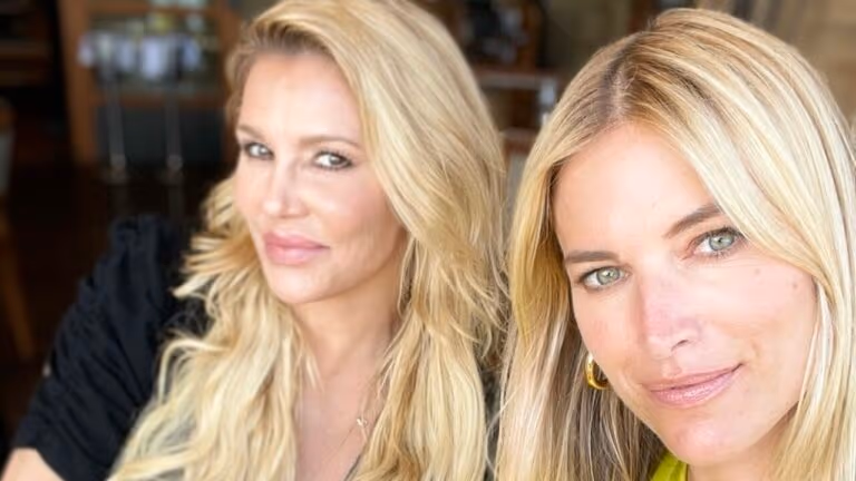 Ex-modelo Brandi Glanville sofre deformação assustadora