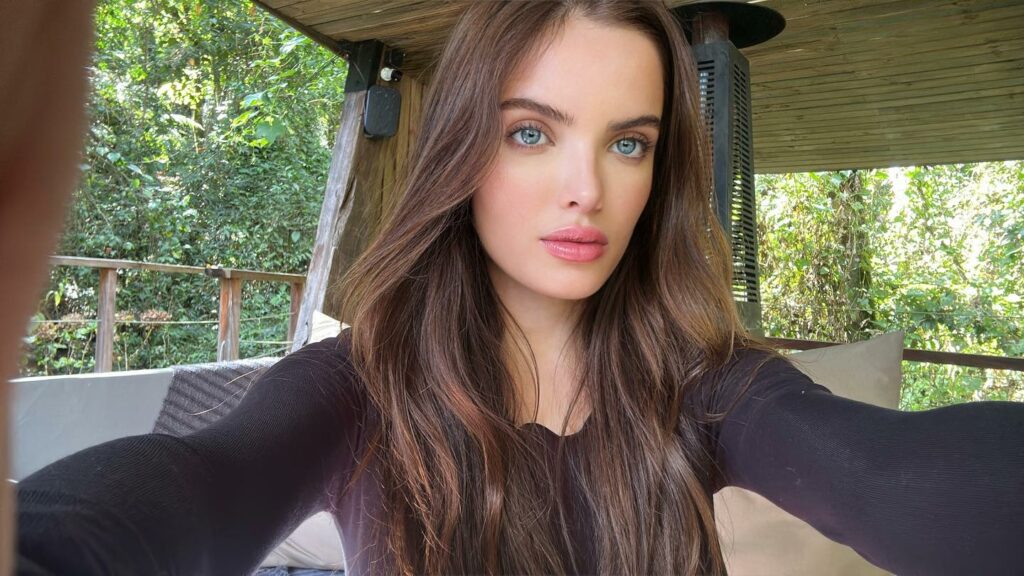 Atriz Giovanna Chaves surpreende com harmonização facial