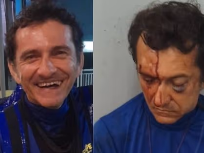 &quot;Ele me chutou na cara e desferiu vários socos&quot;, desabafa entregador agredido