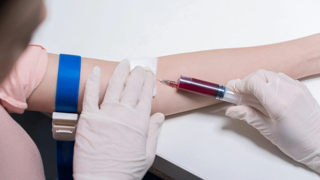 Novo tipo de sangue único é descoberto por cientistas