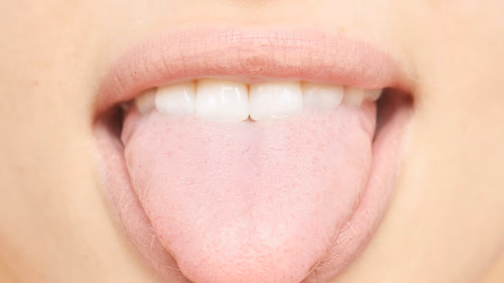 O que o formato da sua língua pode revelar sobre sua saúde, segundo dentistas