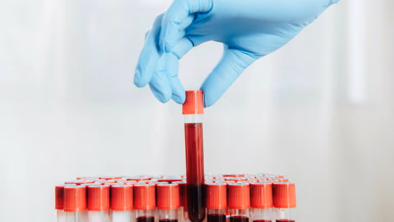 Pesquisa mostra o que pessoas de 100 anos têm no sangue de diferente