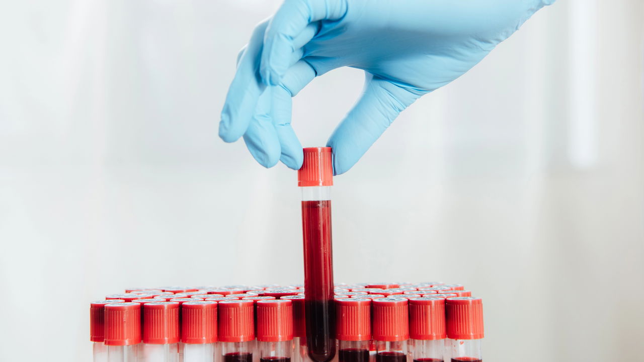 Quem tem esse tipo de sangue tem uma vantagem contra o envelhecimento e pode até viver mais