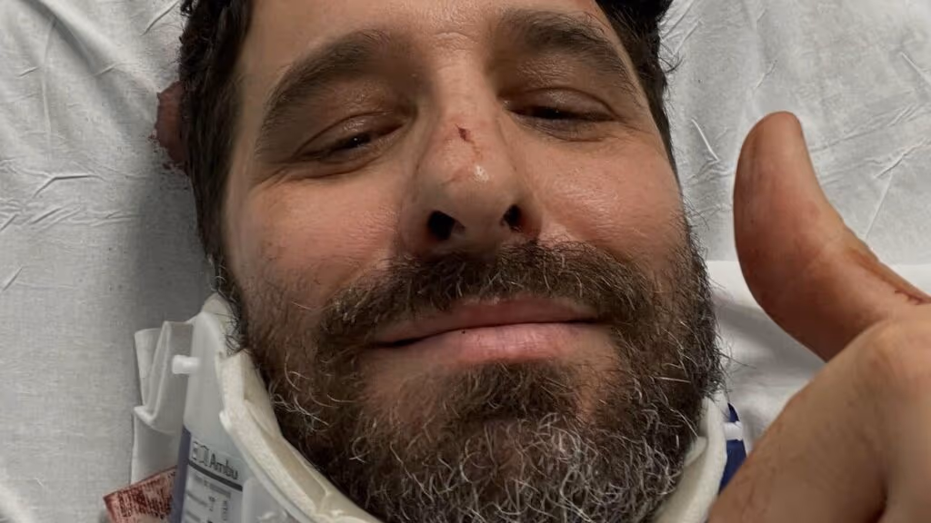 Rafinha Bastos sofre acidente em Nova York e passa por cirurgia