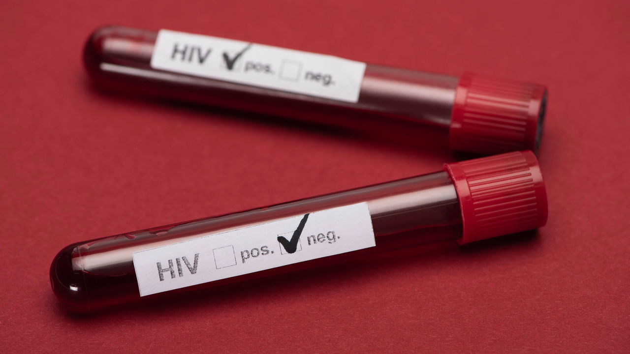 Brasileiro passa por tratamento inovador e se torna 7ª pessoa no mundo a se curar do HIV