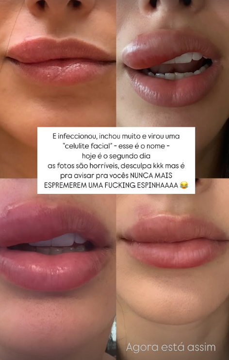 Bruna Biancardi revela motivo assustador de aparecer usando máscara