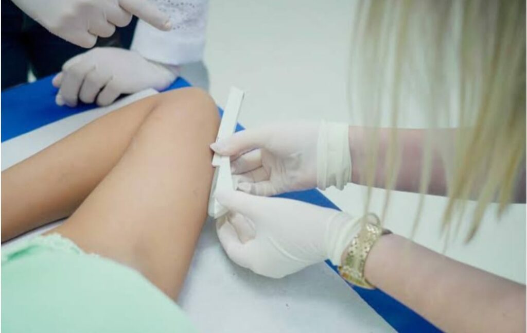 Planos de saúde são obrigados a cobrir implante contraceptivo