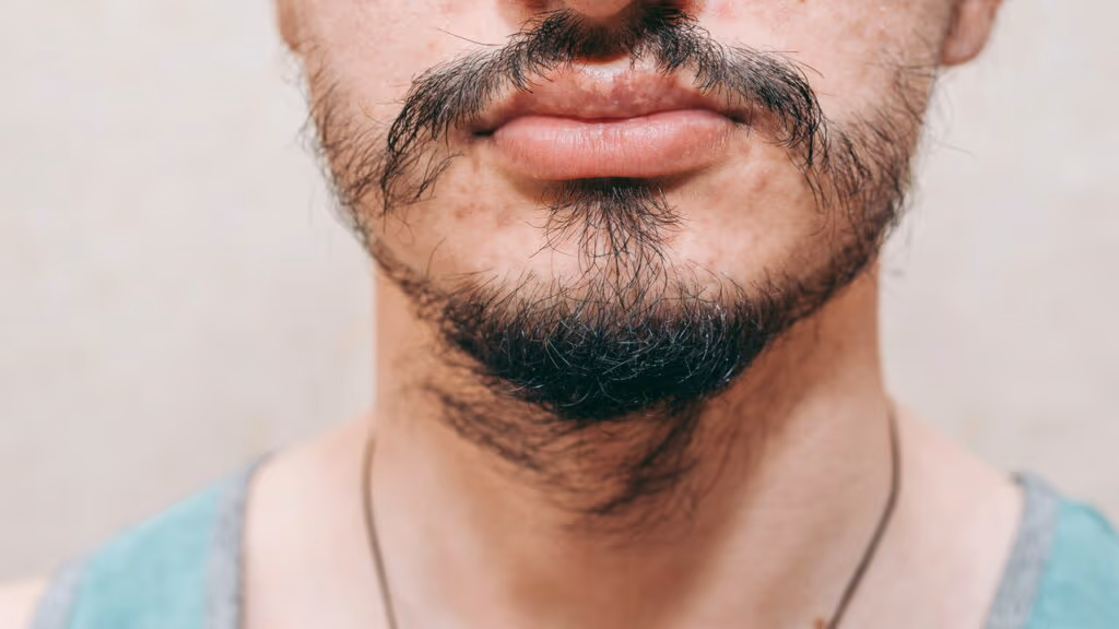 Esse produto virou o xodó dos homens com falhas na barba
