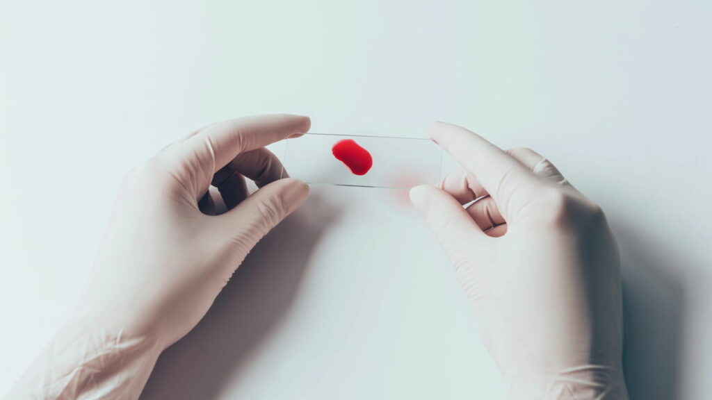 Pessoas com esse tipo de sangue vivem mais tempo: Coincidência ou sorte genética?