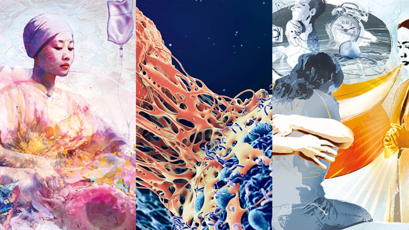 The Lancet: câncer deve aumentar em 61% nos próximos 25 anos