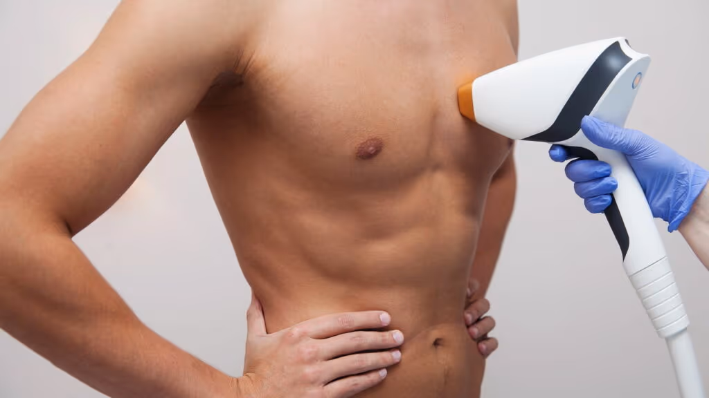 Métodos de depilação masculina e os riscos que ninguém te conta
